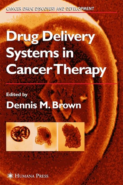 Drug Delivery Systems in Cancer Therapy - 