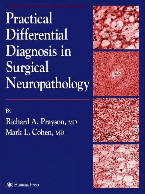 Practical Differential Diagnosis in Surgical Neuropathology -  Mark L. Cohen,  Richard A. Prayson