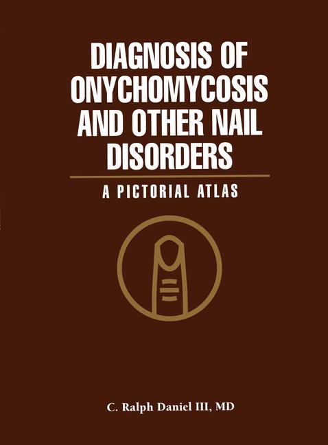 Diagnosis of Onychomycosis and Other Nail Disorders -  C. Ralph III Daniel