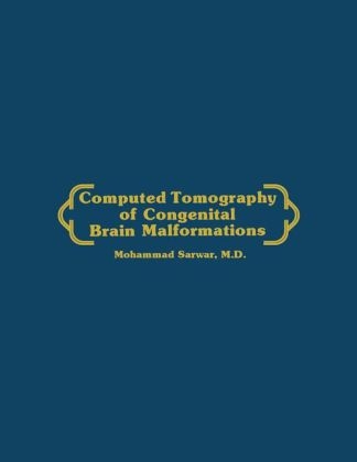 Computed Tomography of Congenital Brain Malformations -  Mohammed Sarwar