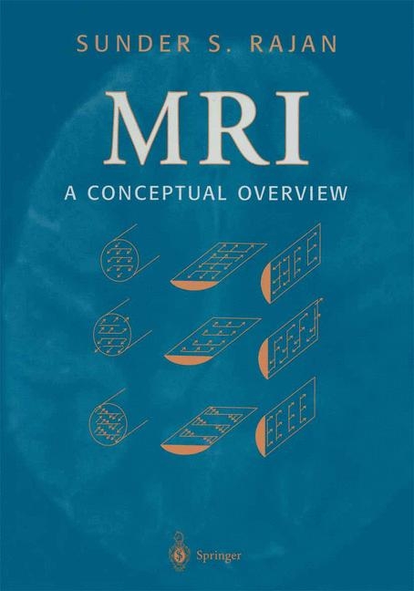 MRI -  Sunder S. Rajan