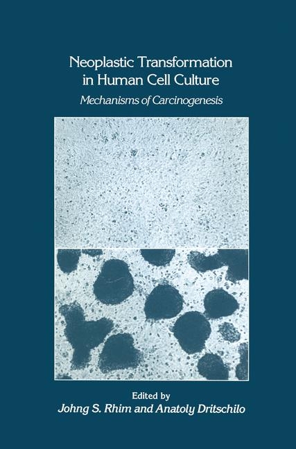 Neoplastic Transformation in Human Cell Culture -  Anatoly Dritschilo,  Johng S. Rhim