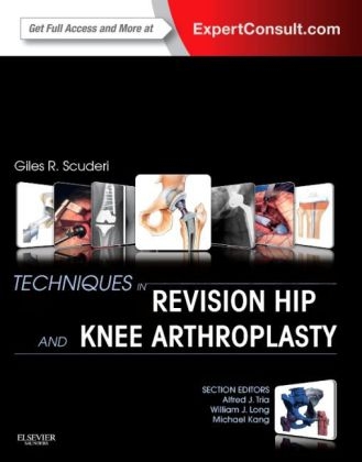 Techniques in Revision Hip and Knee Arthroplasty - Giles R Scuderi