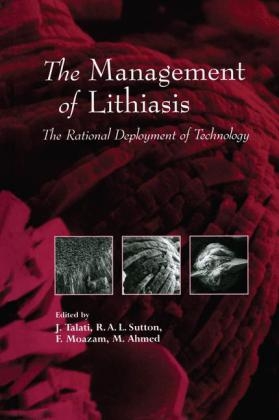 Management of Lithiasis - 