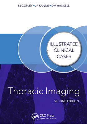Thoracic Imaging - Sue Copley, David Hansell, Jeffrey Kanne