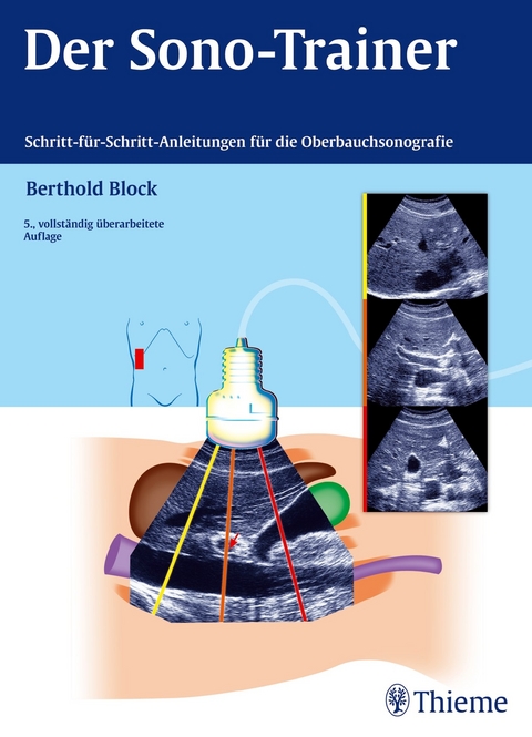 Der Sono-Trainer - Berthold Block