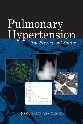 Pulmonary Hypertension - Norbert Voelkel