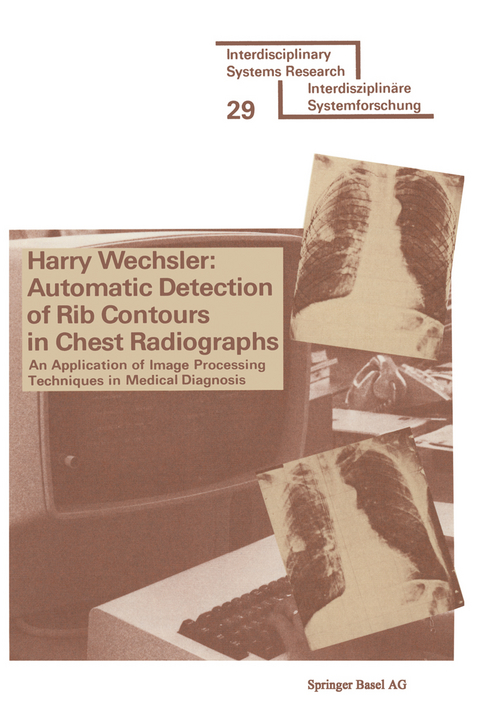 Automatic Detection of Rib Contours in Chest Radiographs -  Wechsler