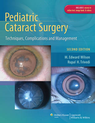 Pediatric Cataract Surgery - M. Edward Wilson, Rupal H. Trivedi