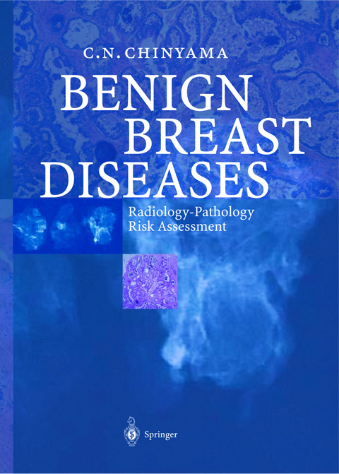 Benign Breast Diseases - Catherine N. Chinyama