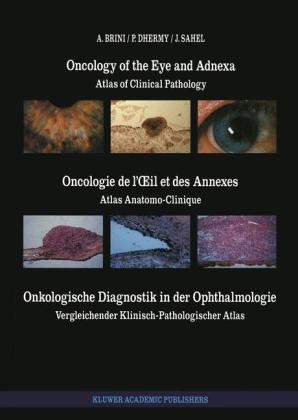 Oncology of the Eye and Adnexa / Oncologie de l' il et des Annexes / Onkologische Diagnostik in der Ophthalmologie -  A. Brini,  A. Dhermy,  J. Sahel