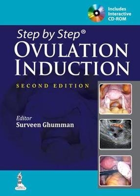 Ovulation Induction - Surveen Gumman