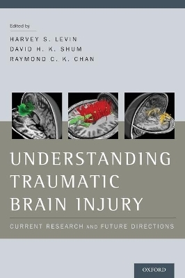 Understanding Traumatic Brain Injury - 