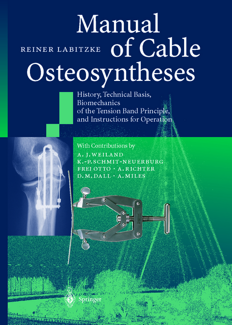 Manual of Cable Osteosyntheses - Reiner Labitzke