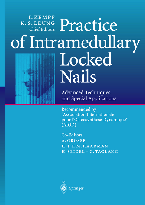 Practice of Intramedullary Locked Nails - 