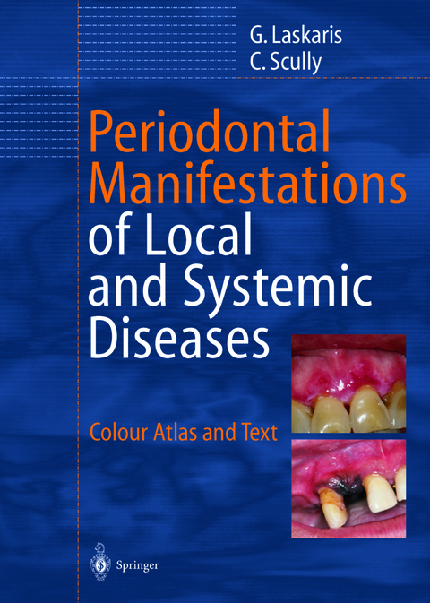 Periodontal Manifestations of Local and Systemic Diseases - George Laskaris, Crispian Scully