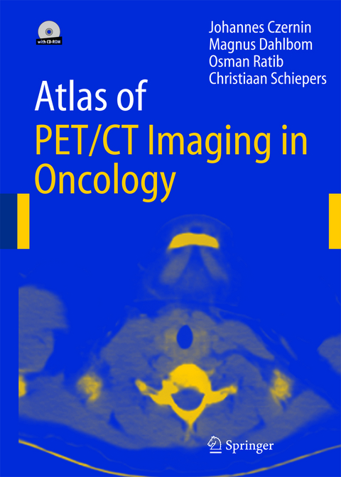 Atlas of PET/CT Imaging in Oncology - Johannes Czernin, Magnus Dahlbom, O. Ratib, Christiaan Schiepers