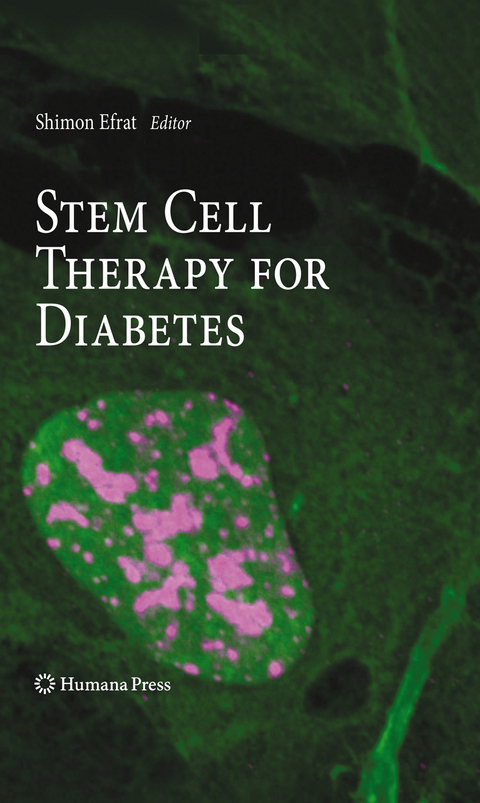 Stem Cell Therapy for Diabetes - 