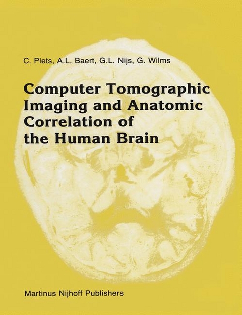 Computer Tomographic Imaging and Anatomic Correlation of the Human Brain - C. Plets, A. Baert, G.L. Nijs, Guido Wilms