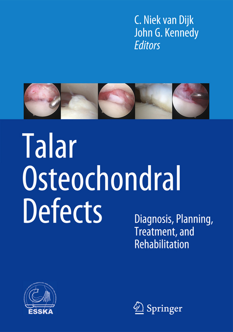 Talar Osteochondral Defects - 