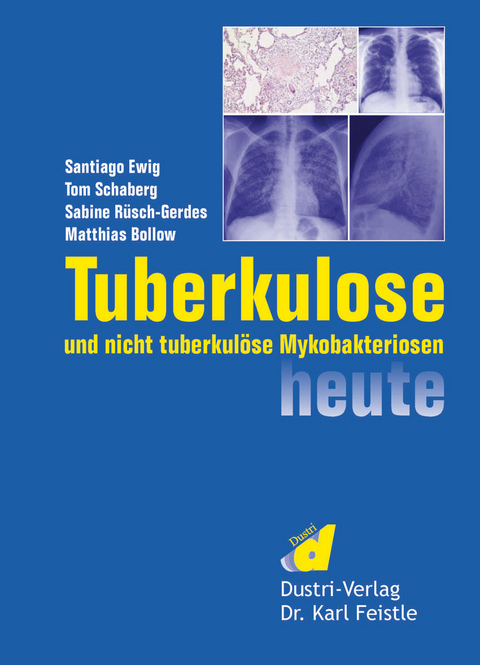 Tuberkulose und nicht tuberkulöse Mykobakteriosen heute -  Santiago Ewig,  Tom Schaberg,  Sabine Rüsch-Gerdes et al.