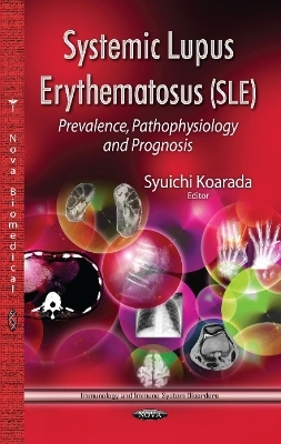 Systemic Lupus Erythematosus (SLE) - 