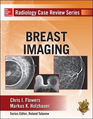 Radiology Case Review Series: Breast Imaging - Chris Flowers, Markus Holzhauer