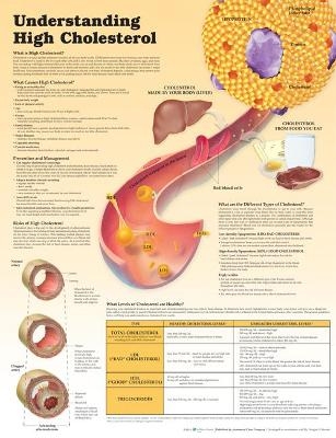 Understanding High Cholesterol Lam - 