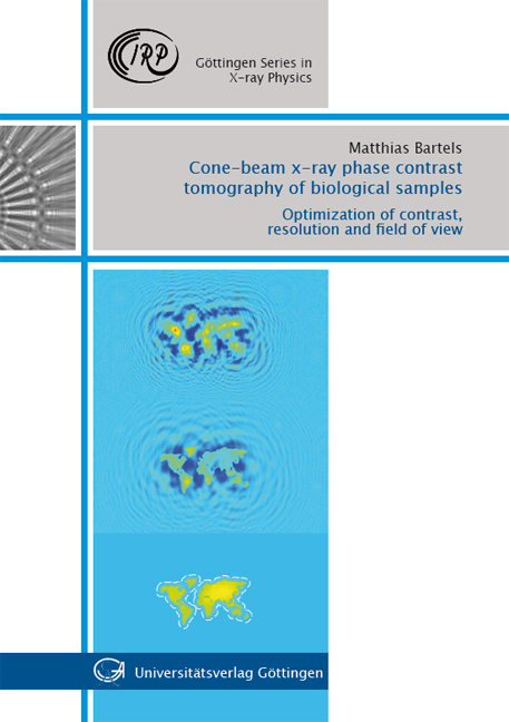 Cone-beam x-ray phase contrast tomography of biological samples - Matthias Bartels
