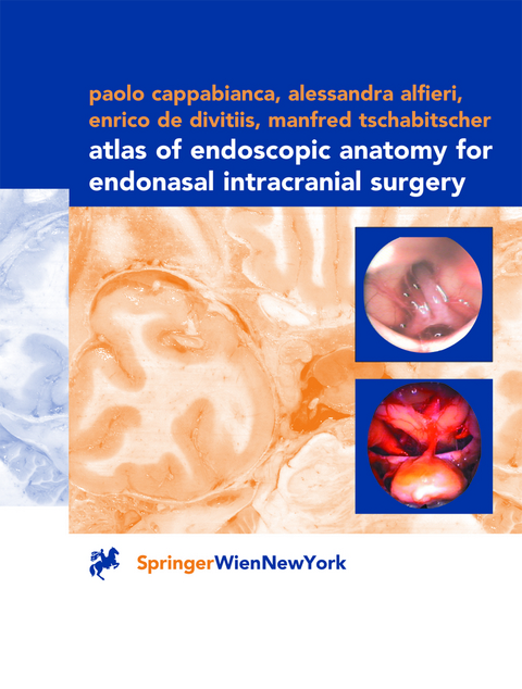 Atlas of Endoscopic Anatomy for Endonasal Intracranial Surgery - Paolo Cappabianca, Alessandra Alfieri, Enrico de Divitiis, Manfred Tschabitscher