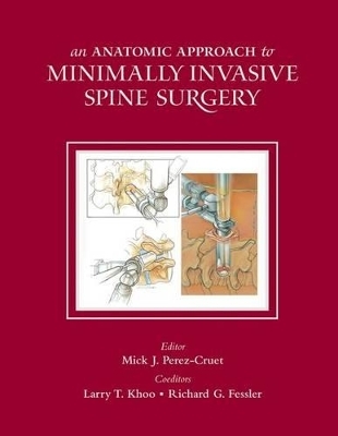 Anatomic Approach to Minimally Invasive Spine Surgery - 