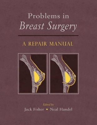 Problems in Breast Surgery - 