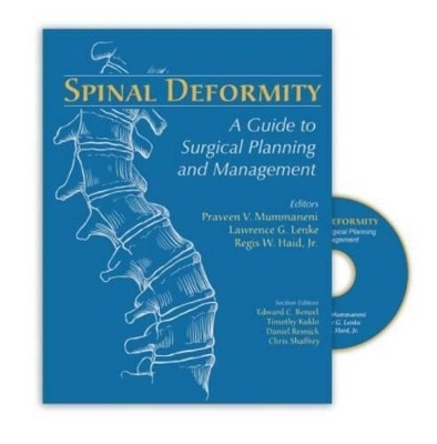 Spinal Deformity - 