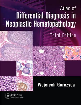 Atlas of Differential Diagnosis in Neoplastic Hematopathology - Wojciech Gorczyca