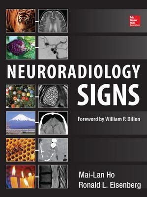 Neuroradiology Signs - Mai-Lan Ho, Ronald Eisenberg