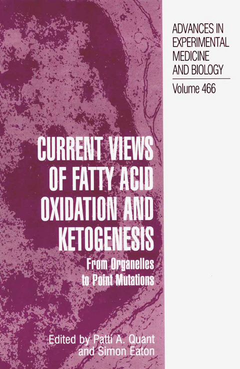 Current Views of Fatty Acid Oxidation and Ketogenesis - 