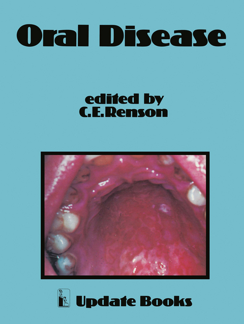 Oral Disease - 