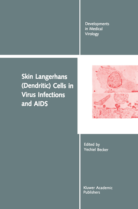 Skin Langerhans (Dendritic) Cells in Virus Infections and AIDS - 