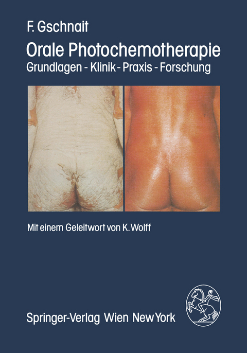 Orale Photochemotherapie - F. Gschnait