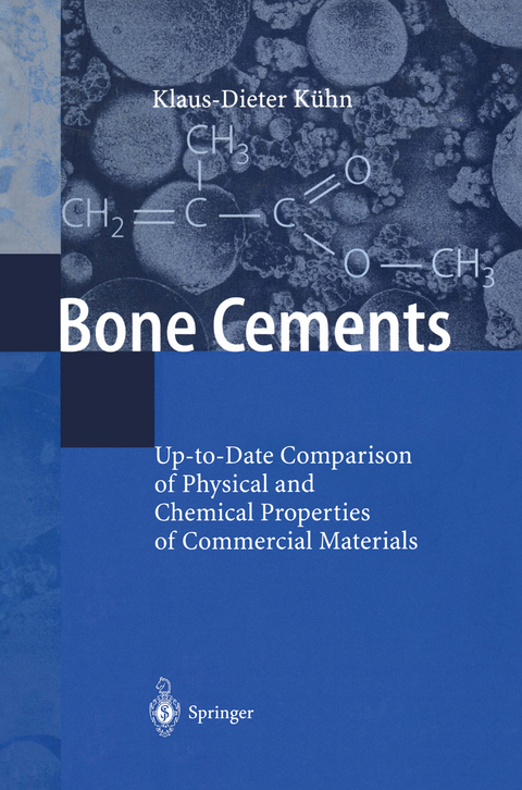 Bone Cements - Klaus-Dieter Kühn