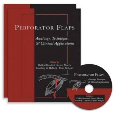 Perforator Flaps - 