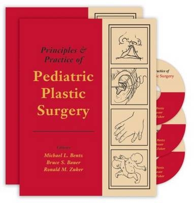 Principles and Practice of Pediatric Plastic Surgery - 