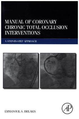 Manual of Coronary Chronic Total Occlusion Interventions - Emmanouil Brilakis
