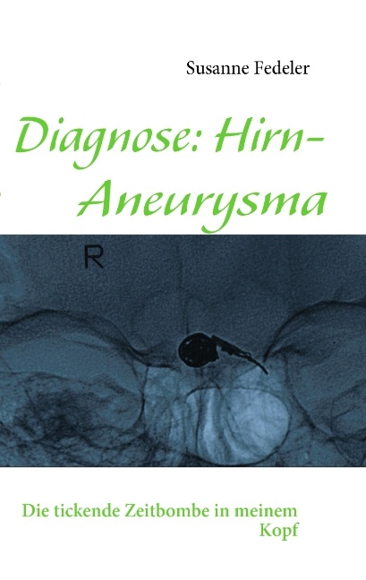 Diagnose: Hirn-Aneurysma - Susanne Fedeler