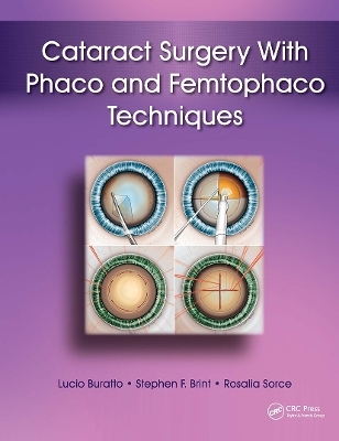 Cataract Surgery With Phaco and Femtophaco Techniques - Lucio Buratto, Stephen Brint, Rosalia Sorce