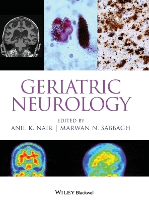 Geriatric Neurology - 
