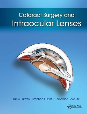 Cataract Surgery and Intraocular Lenses - Lucio Buratto, Stephen Brint, Domenico Boccuzzi