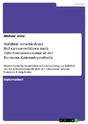 StabilitÃ¤t verschiedener Refixationsverfahren nach Tuberositasosteotomie in der Revisions-Knieendoprothetik - Michael Dietz