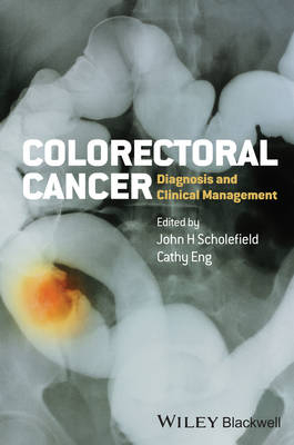 Colorectal Cancer - 