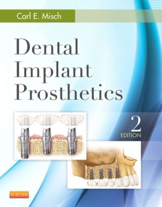 Dental Implant Prosthetics - Carl E. Misch